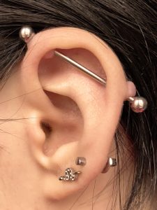 industrial ear piercing keloid